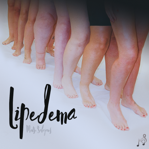 Lipedema lite